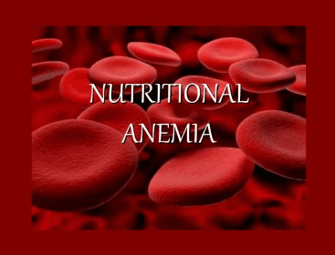 Nutritional Anemia: Understanding and Managing